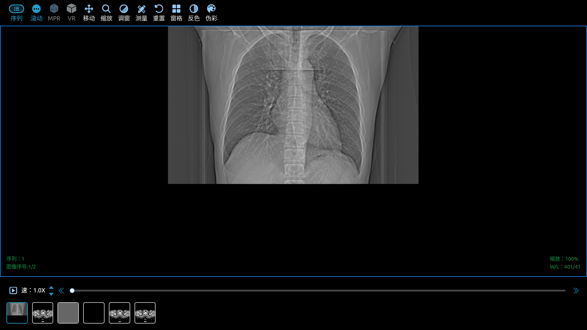 图像展示 How to load Dicom Image With WADO-RS