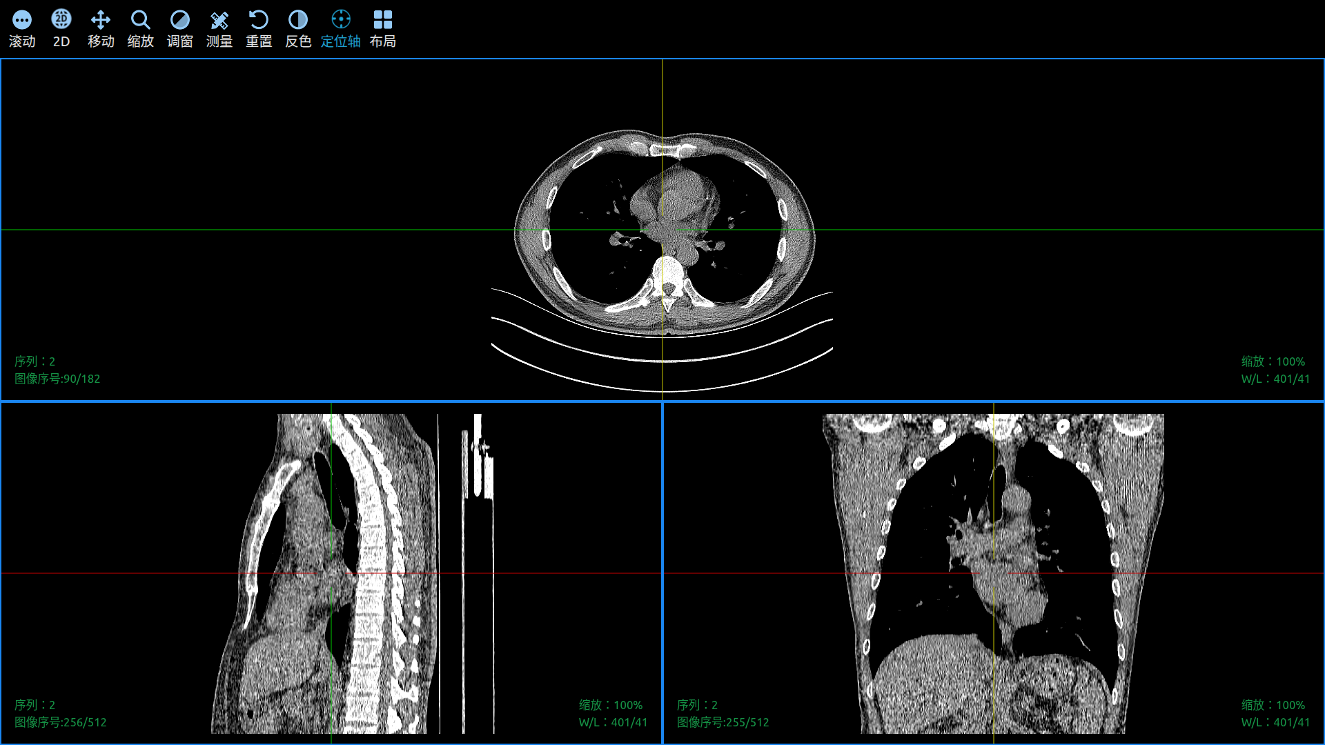 MPR DICOM MPR Reconstructor
