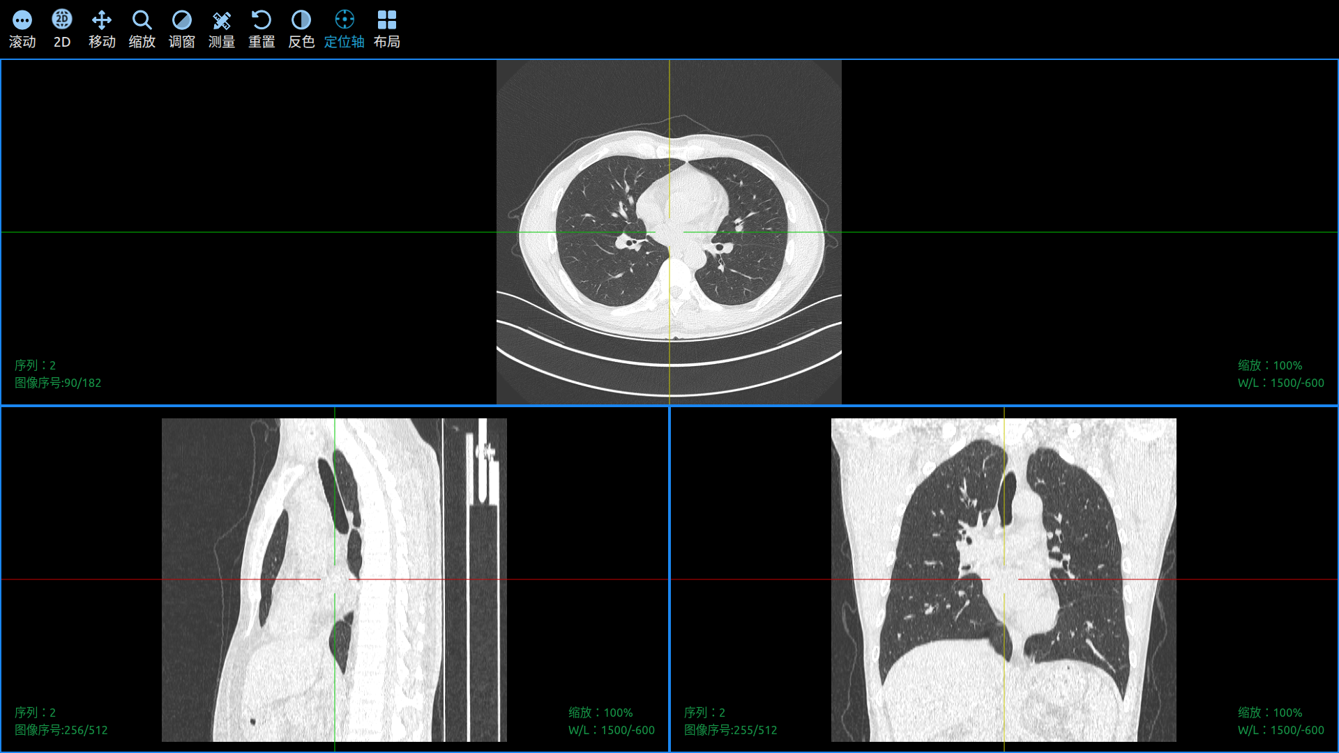 MP2 DICOM Viewer MPR With CrossHair