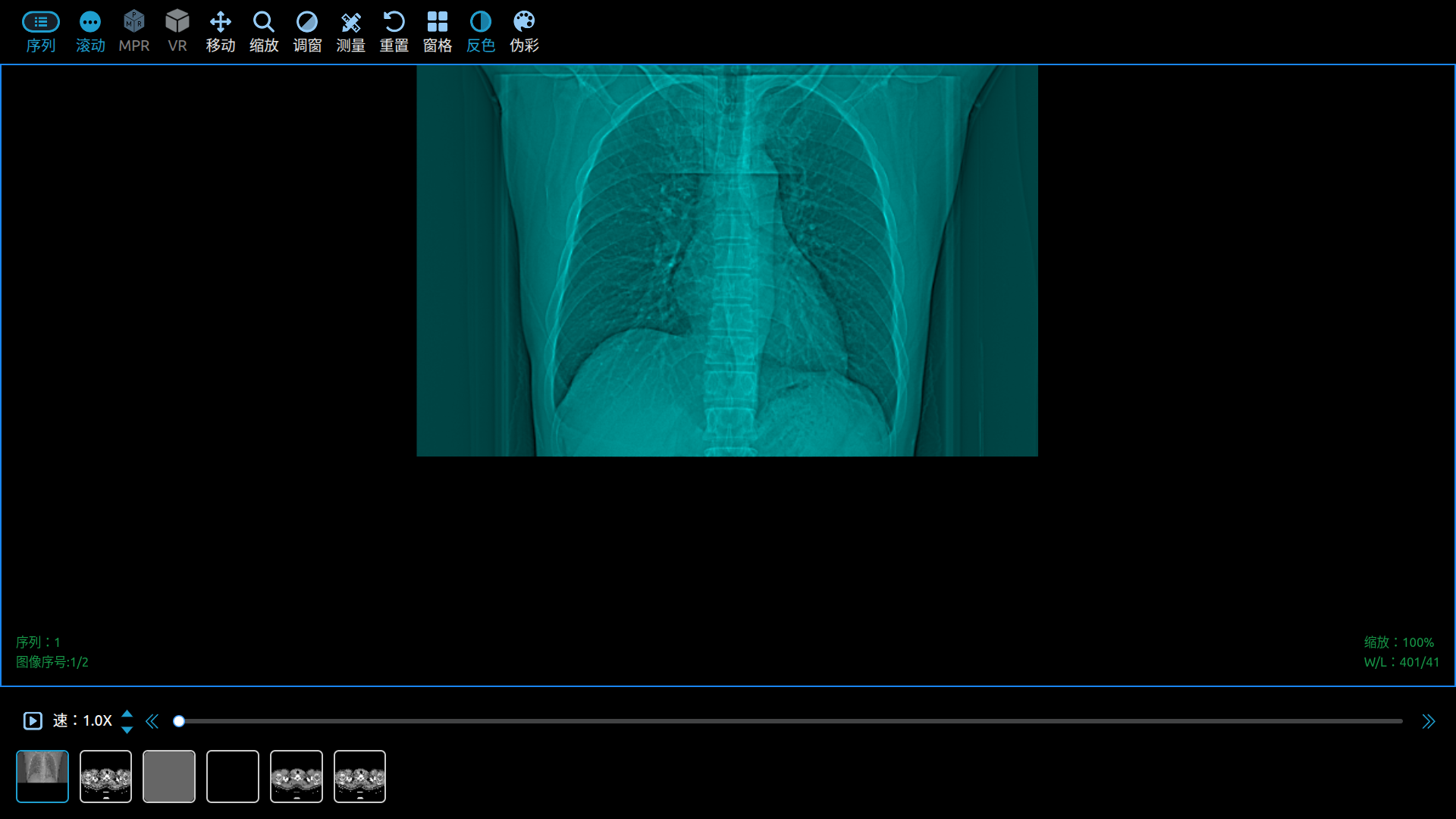 反色功能 DICOM Viewer Invert Color