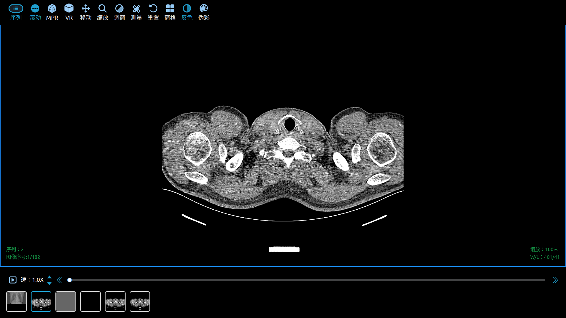 DICOM View Load Default CT Images