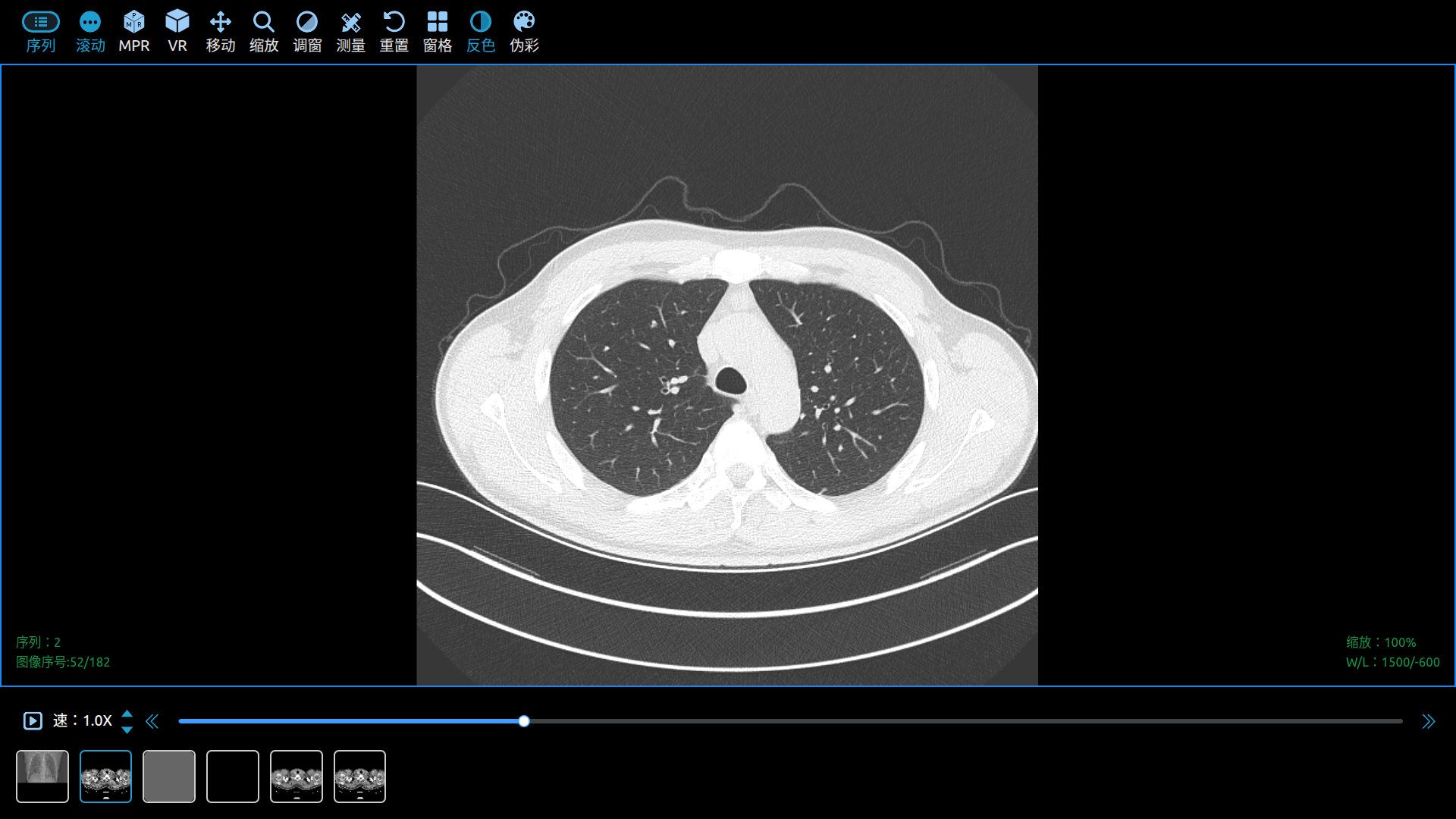 调窗 DICOM Viewer Adjust   WINDOWS Level/Windows Center