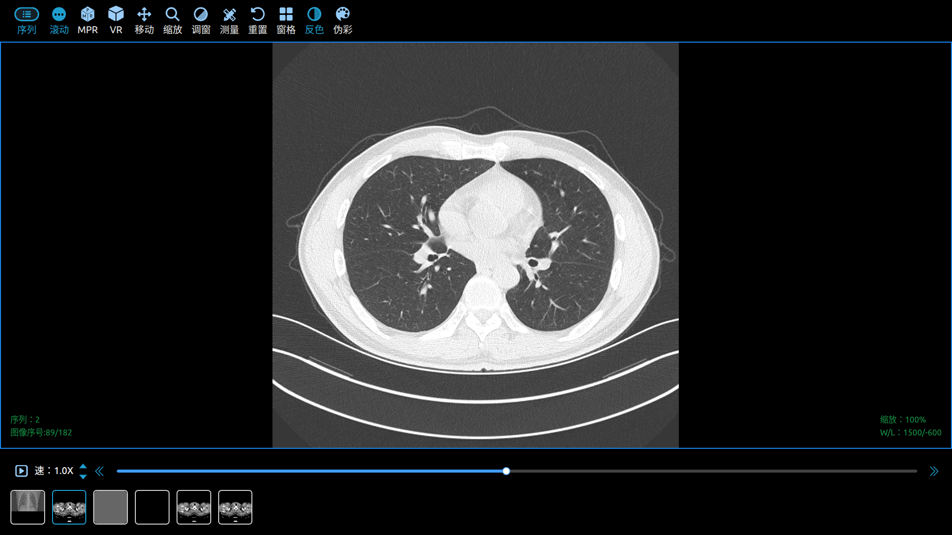 移动 DICOM Viewer  Scroll